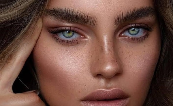 هزینه عمل چشم روباهی و نکات ضروری پیش از آن