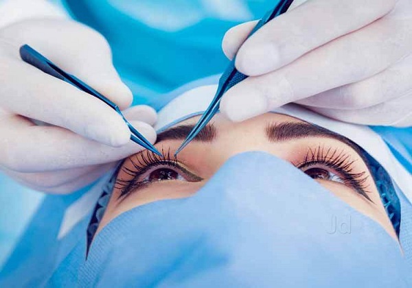 مزایای جدیدترین روش‌های جراحی چشم