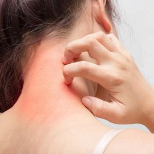 بررسی اصلی‌ترین علت خارش بدن در شب