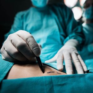 عمل لیپوماتیک چیست و چگونه انجام می‌شود؟