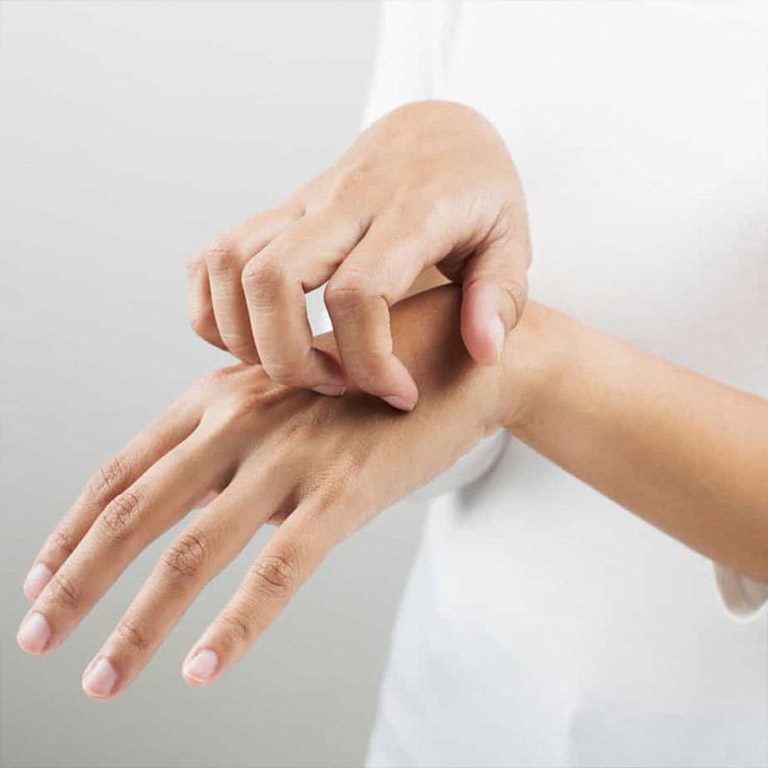 چه زمانی خارش بدن خطرناک است؟